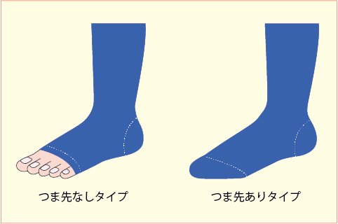 下肢静脈瘤における医療用弾性ストッキングを用いた圧迫療法 医療用弾性ストッキングの効果と使用目的 下肢静脈瘤を正しく見極める アルメディアweb